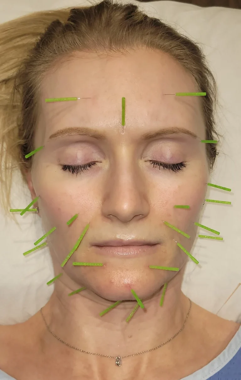 Facial acu 768x1210