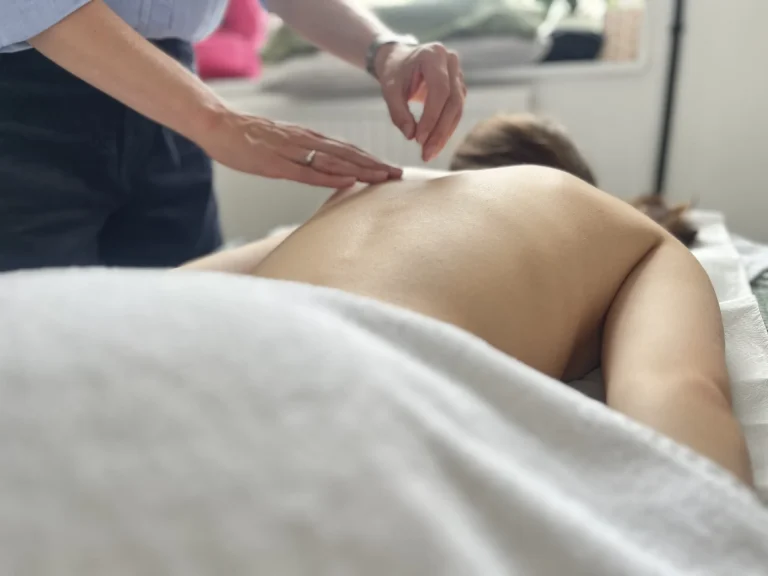 Acupuncture for stress 768x576