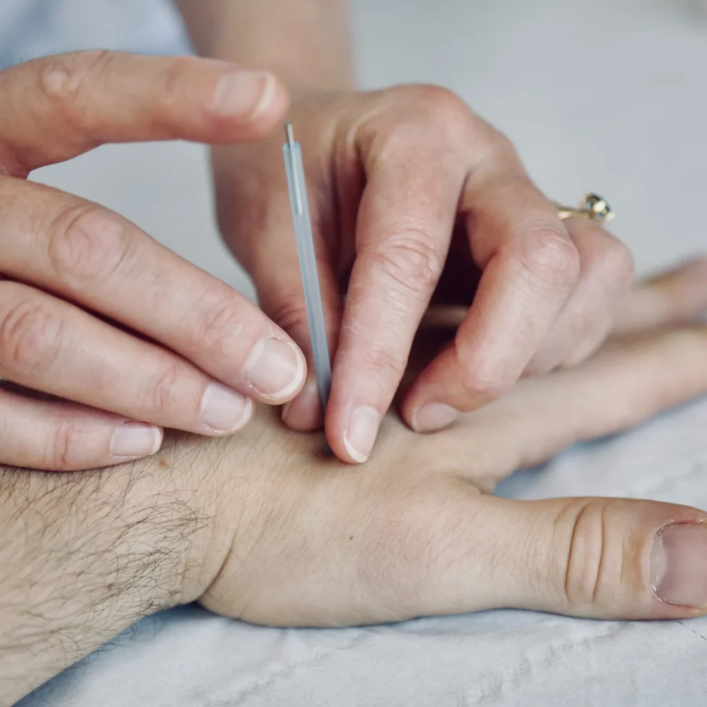 Needling 1 1024x1024